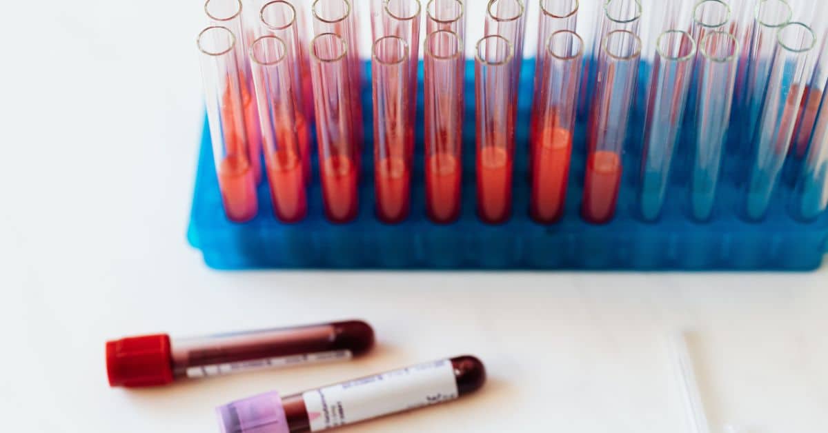 Are Blood -based Drug Test Accurate