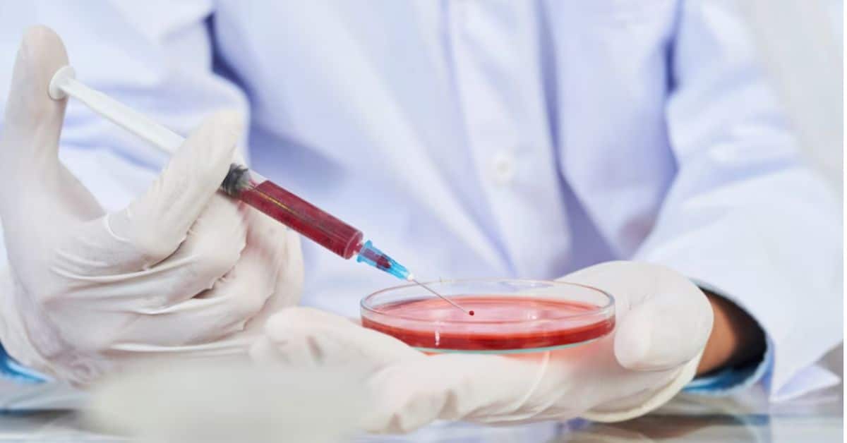Read more about the article The Art of Sample Preservation: Ensuring Test Integrity in Blood Test Laboratories