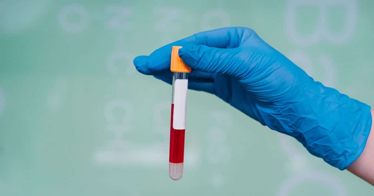 Read more about the article Best Blood Test in Punjab