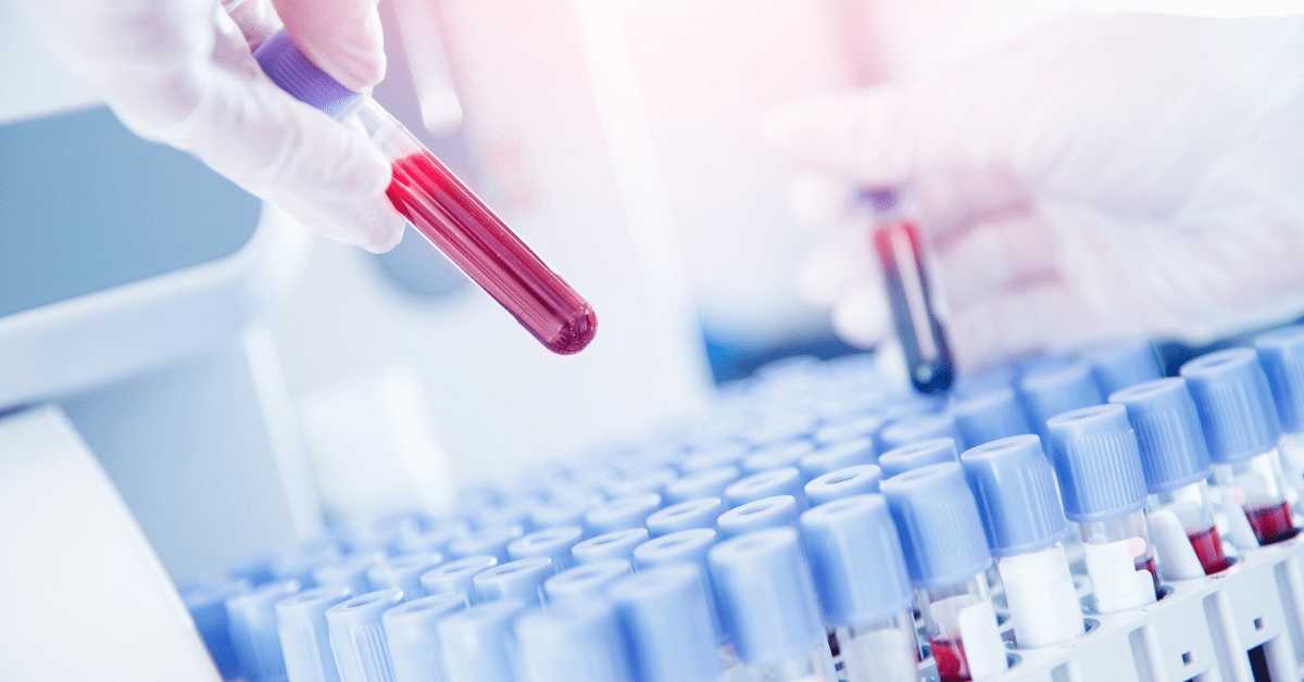 Blood Tests and Disease Prevention: Insights from the Best Laboratory in Patiala