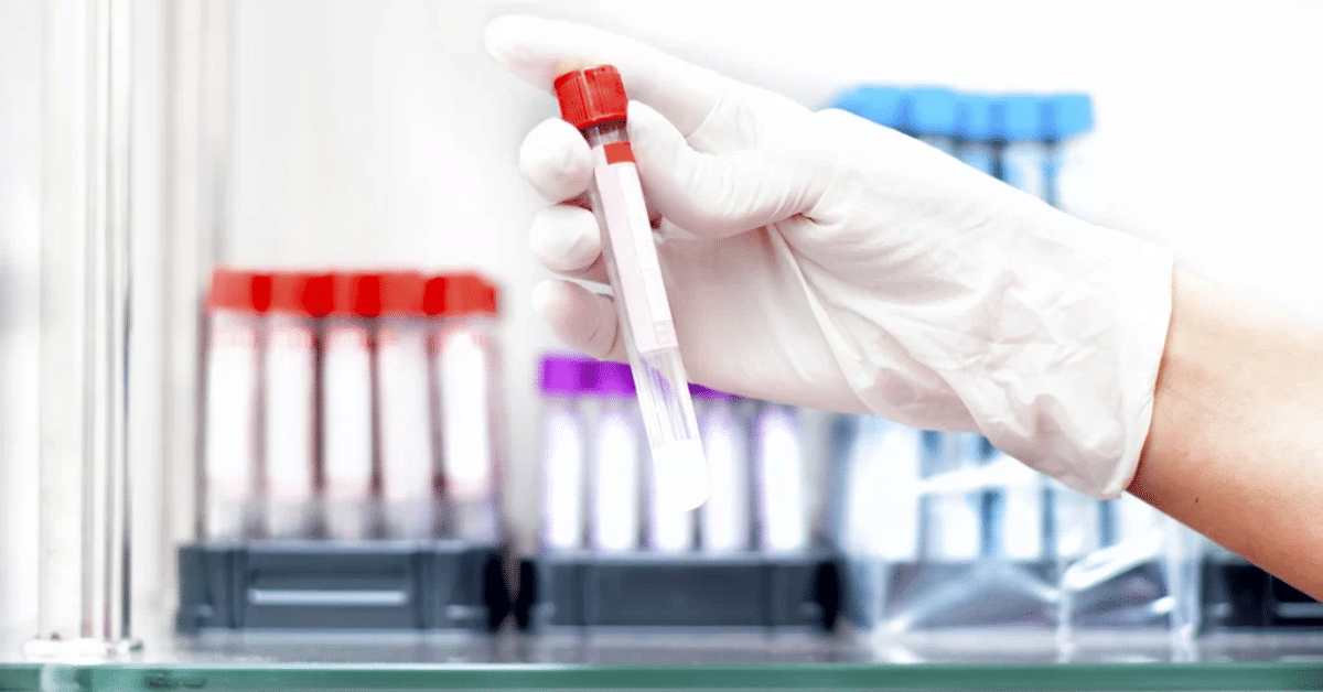 The Evolution of Point-of-Care Blood Testing: Insights from Blood Test in Patiala