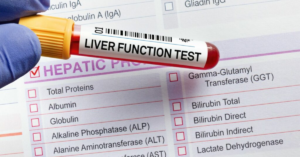 Read more about the article The Role of LFT Tests: Insights from the Best Medical Lab for LFT Test in Patiala