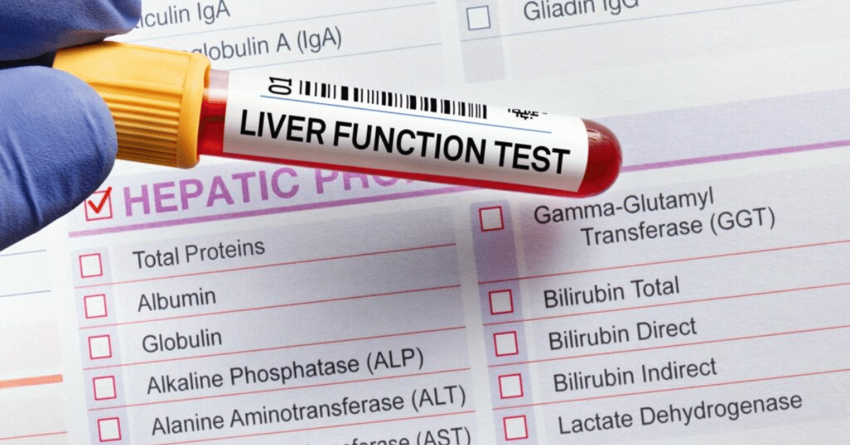 The Role of LFT Tests: Insights from the Best Medical Lab for LFT Test in Patiala