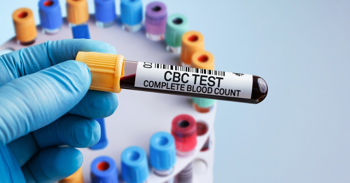 The Role of CBC Blood Test in Cancer Diagnosis and Treatment