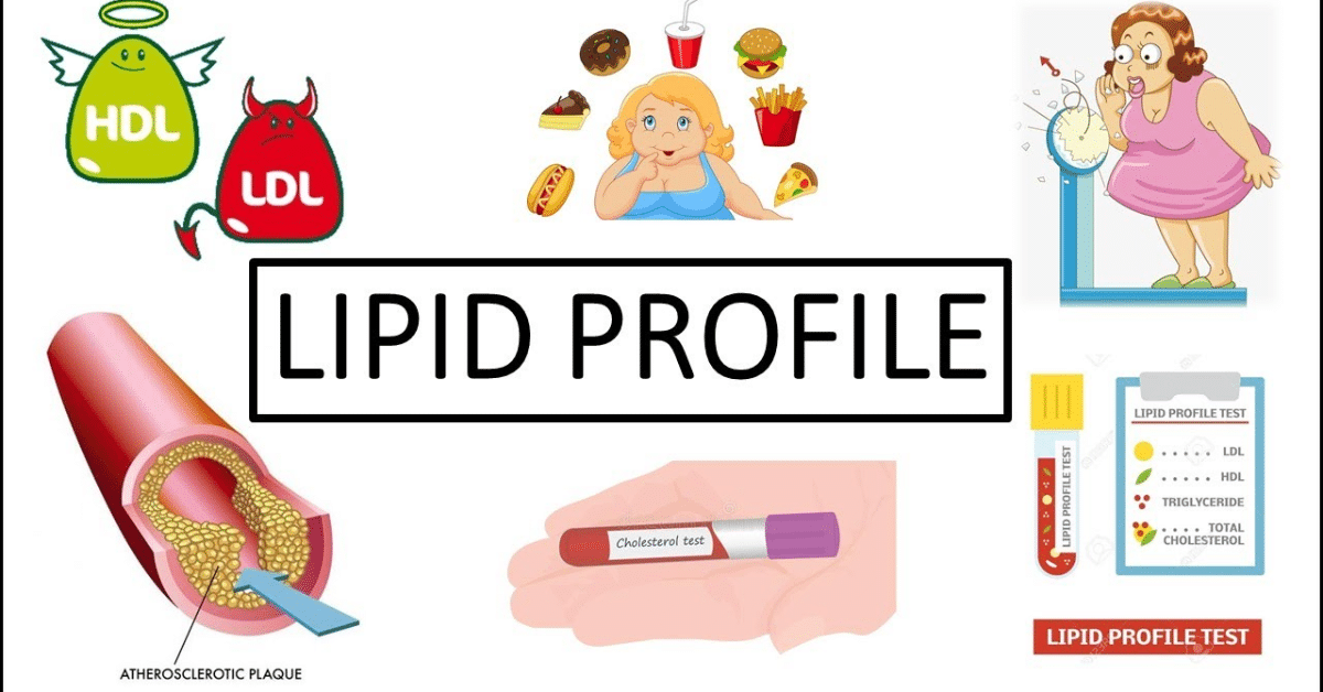 Understanding Cardiovascular Health: The Importance of Lipid Profile Testing