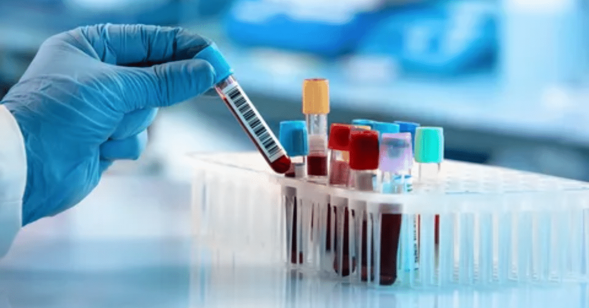 Read more about the article 7 Reasons Why Lab Tests Are Important: Blood Test Lab in Patiala Insights